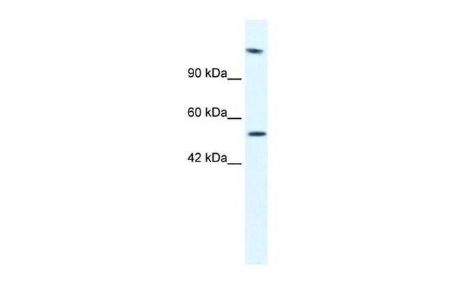 HELB Antibody in Western Blot (WB)