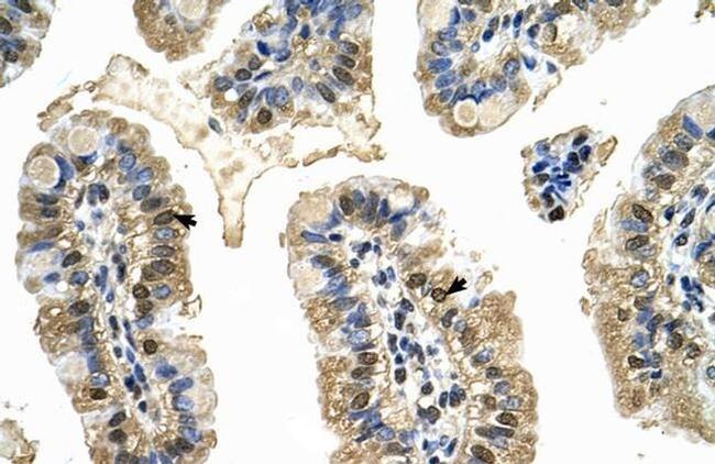 MCM8 Antibody in Immunohistochemistry (IHC)