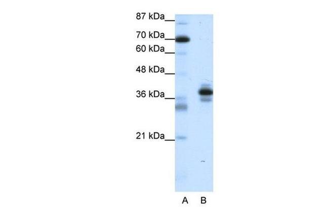 PITX1 Antibody in Western Blot (WB)