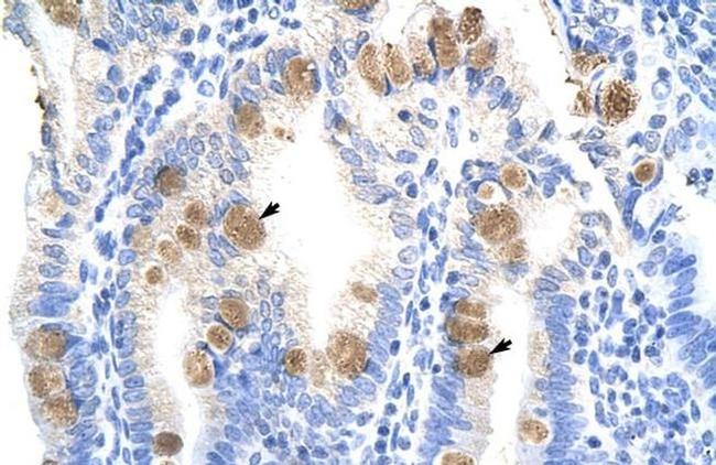 TEF5 Antibody in Immunohistochemistry (IHC)