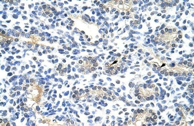 BLZF1 Antibody in Immunohistochemistry (IHC)