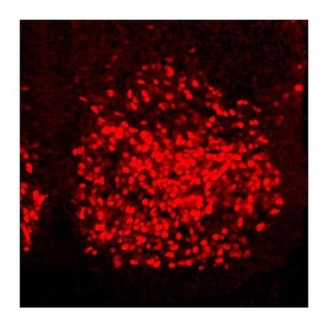 HOXC6 Antibody in Immunohistochemistry (IHC)