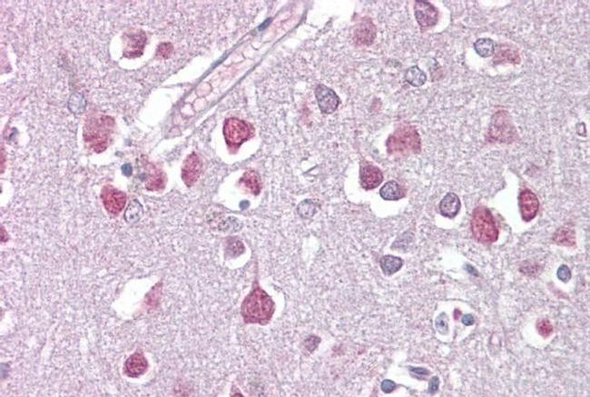 ETV1 Antibody in Immunohistochemistry (IHC)