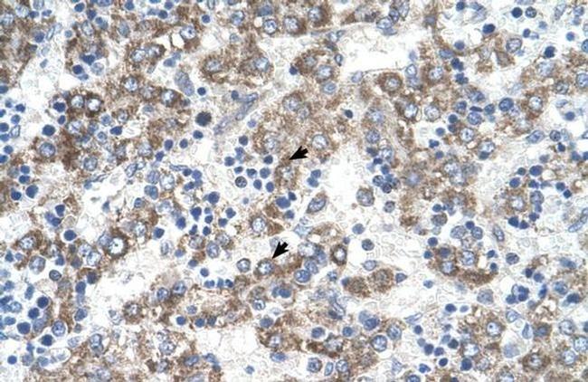 DLX5 Antibody in Immunohistochemistry (IHC)