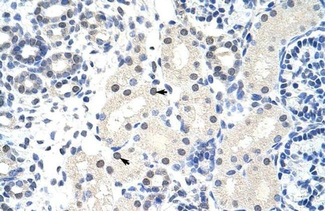 FOXG1 Antibody in Immunohistochemistry (IHC)