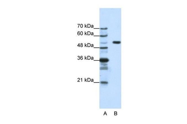 HCFC1 Antibody in Western Blot (WB)