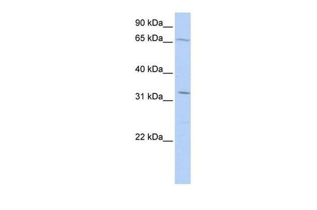 TRIM22 Antibody in Western Blot (WB)