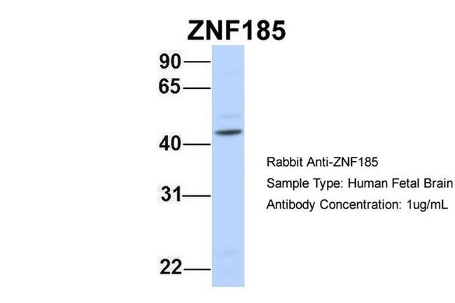 ZNF185 Antibody in Western Blot (WB)