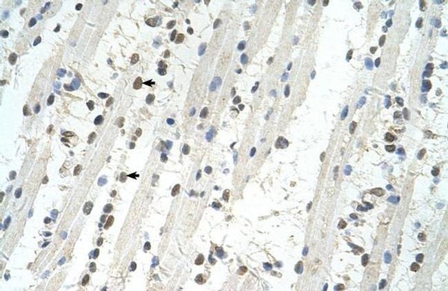 TRIM32 Antibody in Immunohistochemistry (IHC)