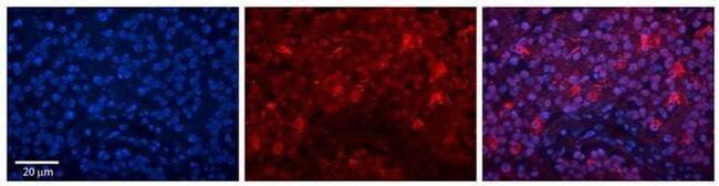 ILF3 Antibody in Immunohistochemistry (Paraffin) (IHC (P))