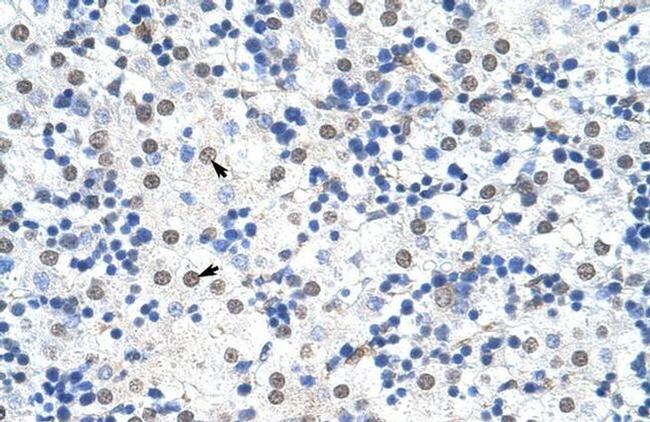 IKZF3 Antibody in Immunohistochemistry (IHC)