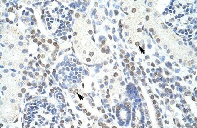 POGZ Antibody in Immunohistochemistry (IHC)