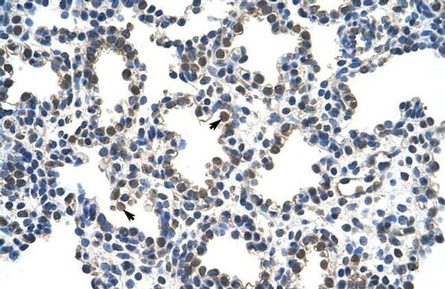 RCOR1 Antibody in Immunohistochemistry (Paraffin) (IHC (P))