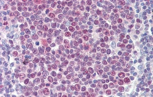 HIC5 Antibody in Immunohistochemistry (IHC)