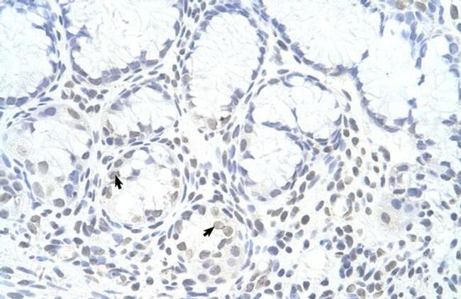 ZNF580 Antibody in Immunohistochemistry (IHC)