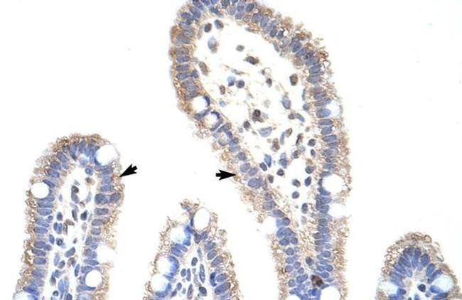 METTL3 Antibody in Immunohistochemistry (IHC)