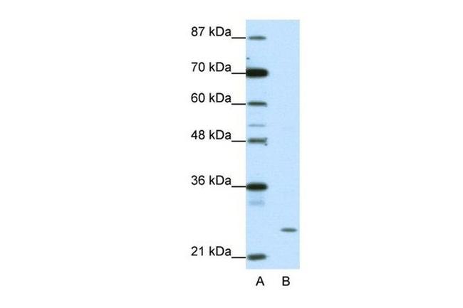 ZNF253 Antibody in Western Blot (WB)