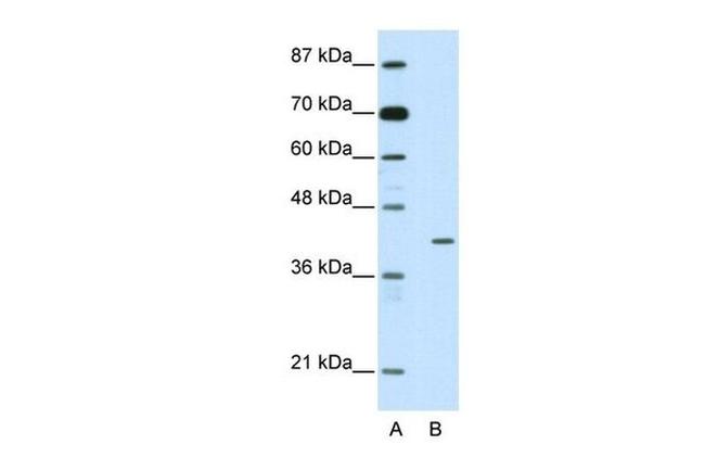 HMBOX1 Antibody in Western Blot (WB)