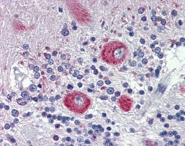 GRHL2 Antibody in Immunohistochemistry (Paraffin) (IHC (P))