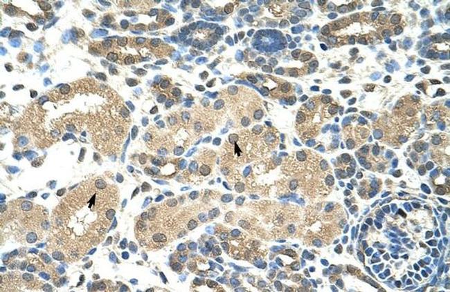 DMRT2 Antibody in Immunohistochemistry (IHC)