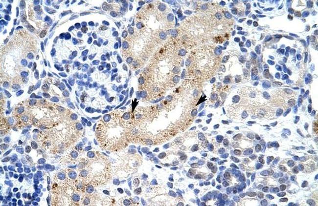 ZFP57 Antibody in Immunohistochemistry (IHC)