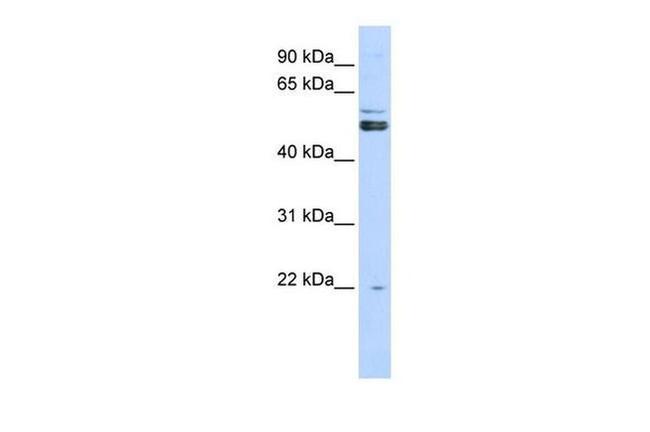 PRMT2 Antibody in Western Blot (WB)