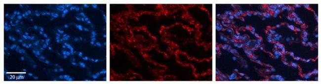 RPL13 Antibody in Immunohistochemistry (Paraffin) (IHC (P))