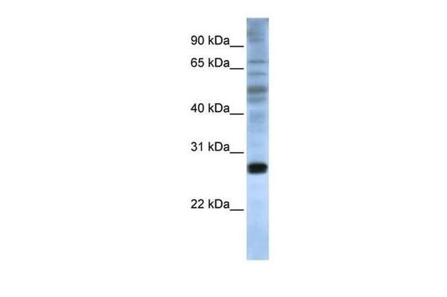 eIF4E Antibody in Western Blot (WB)