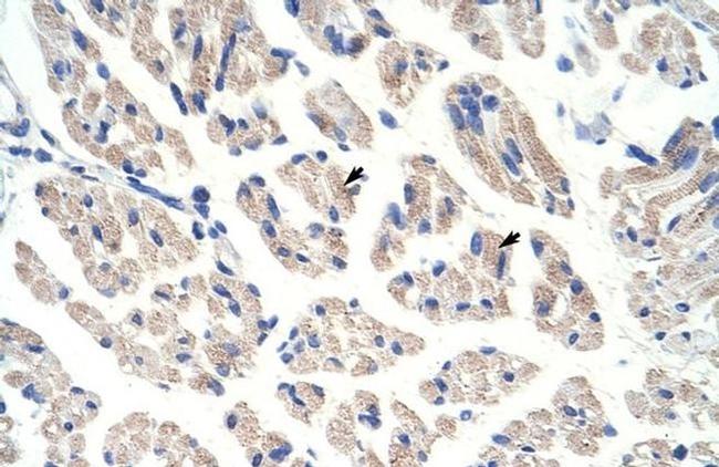 Aconitase 1 Antibody in Immunohistochemistry (Paraffin) (IHC (P))