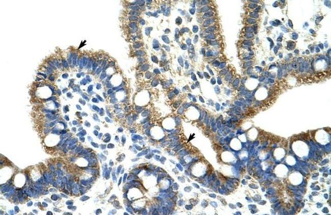 CPNE1 Antibody in Immunohistochemistry (Paraffin) (IHC (P))