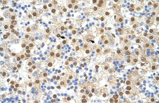 ILF3 Antibody in Immunohistochemistry (Paraffin) (IHC (P))