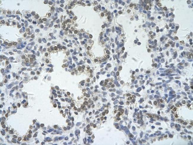 ZRSR2 Antibody in Immunohistochemistry (Paraffin) (IHC (P))