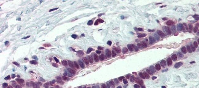 PCBP1 Antibody in Immunohistochemistry (Paraffin) (IHC (P))