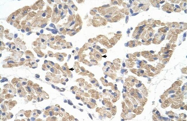 FARS2 Antibody in Immunohistochemistry (Paraffin) (IHC (P))