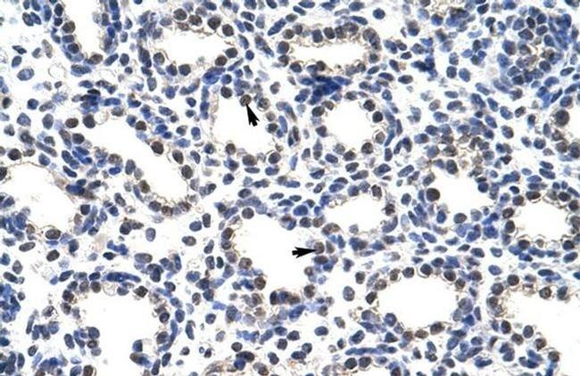 POP4 Antibody in Immunohistochemistry (Paraffin) (IHC (P))