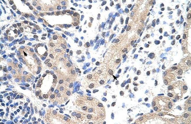 SNRPD1 Antibody in Immunohistochemistry (Paraffin) (IHC (P))