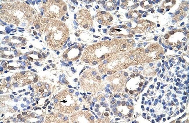 EXOSC7 Antibody in Immunohistochemistry (Paraffin) (IHC (P))