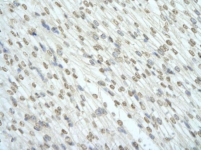 RBM7 Antibody in Immunohistochemistry (Paraffin) (IHC (P))