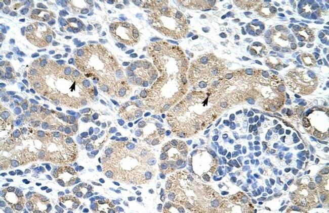 RBM38 Antibody in Immunohistochemistry (Paraffin) (IHC (P))