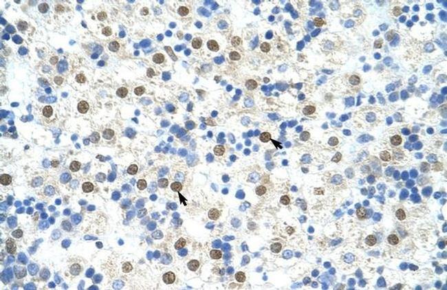 DAZAP1 Antibody in Immunohistochemistry (Paraffin) (IHC (P))