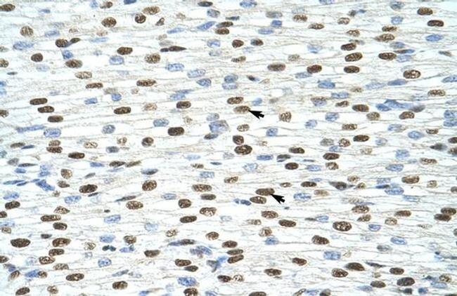 EXOSC4 Antibody in Immunohistochemistry (Paraffin) (IHC (P))