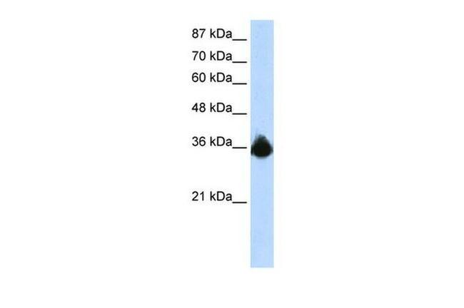 PTBP2 Antibody in Western Blot (WB)