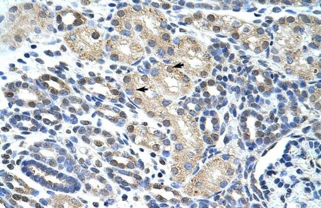 eIF4H Antibody in Immunohistochemistry (Paraffin) (IHC (P))