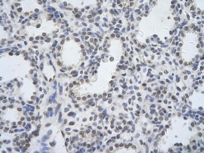 DDX17 Antibody in Immunohistochemistry (Paraffin) (IHC (P))