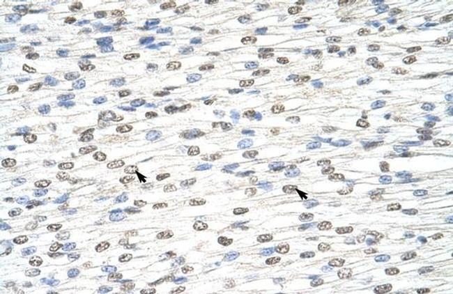 DIS3L2 Antibody in Immunohistochemistry (Paraffin) (IHC (P))