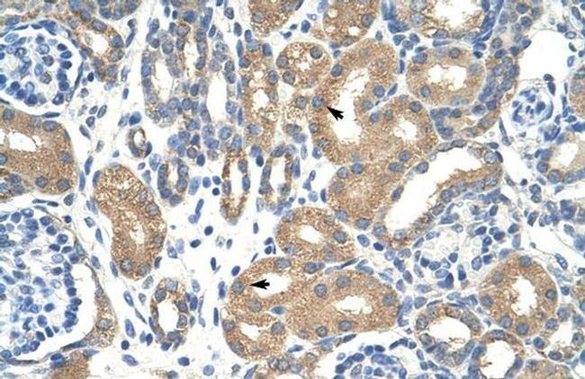 APOBEC3D Antibody in Immunohistochemistry (Paraffin) (IHC (P))