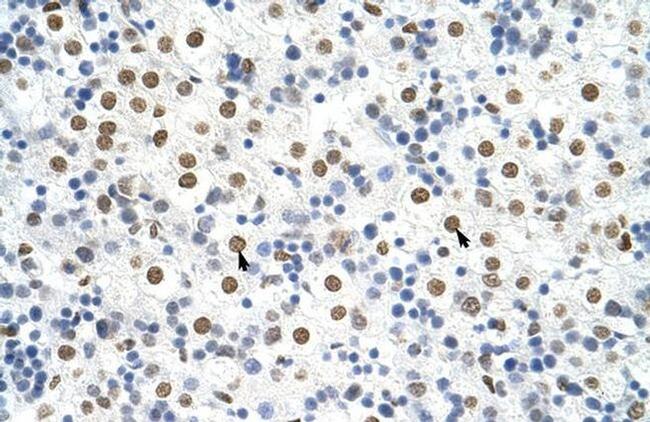 hnRNP A3 Antibody in Immunohistochemistry (Paraffin) (IHC (P))