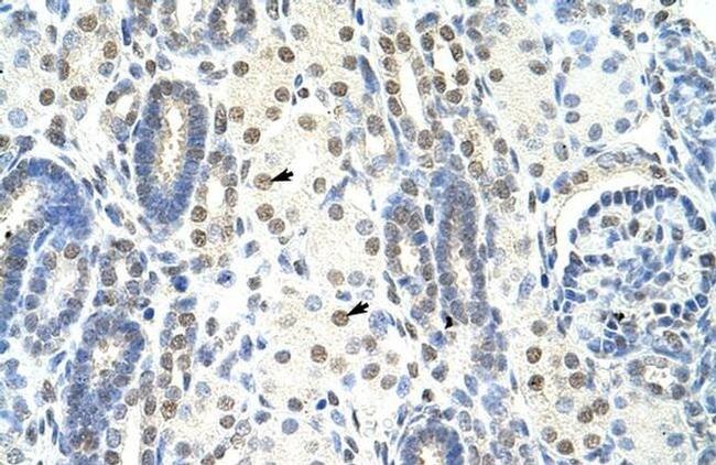 SF1 Antibody in Immunohistochemistry (Paraffin) (IHC (P))