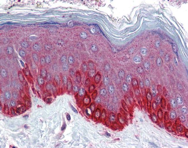 FZD4 Antibody in Immunohistochemistry (IHC)