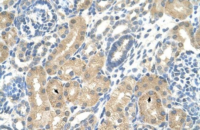 KHK Antibody in Immunohistochemistry (Paraffin) (IHC (P))